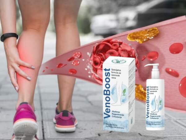 VenoBoost gel Srbija - Cena gdje kupiti iskustva  Kako se koristi